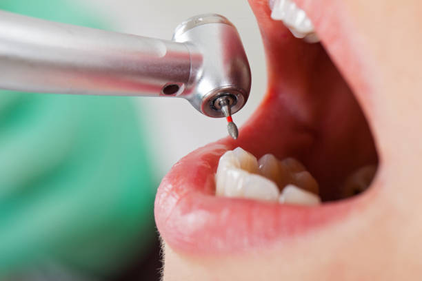 Best Pediatric Emergency Dentist in Loving, NM